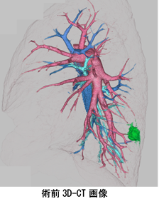 術前 3D-CT画像