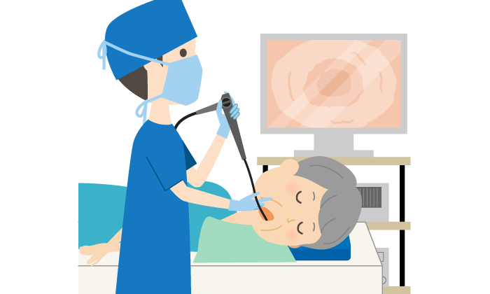 標準ドック（胃内視鏡）